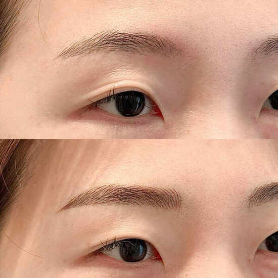 눈썹문신 엠보
