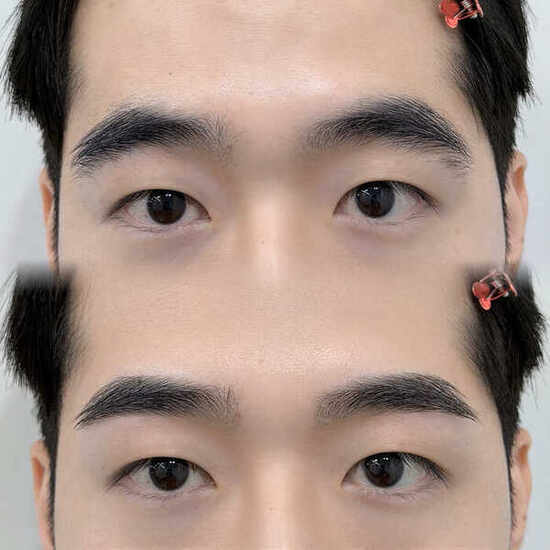 눈썹왁싱